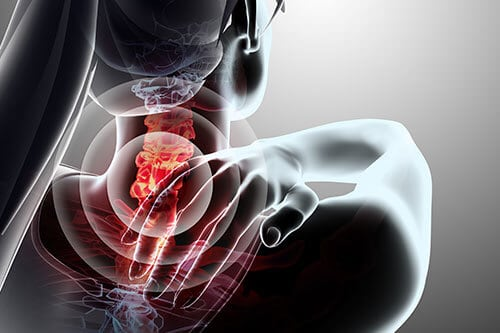 some painful facts about whiplash claims